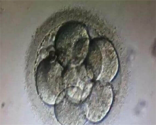 广东借卵包成功,子宫内膜活跃对胚胎着床好不好
						