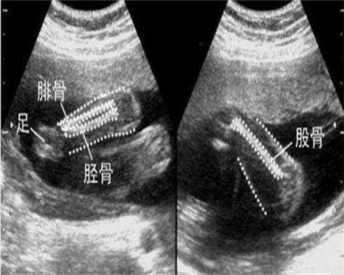 四川试管婴儿哪里医院比较好,四川试管成功率比较高的医院