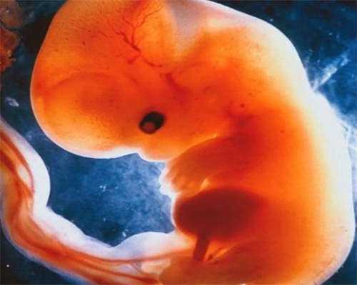 重庆多囊试管费用报销