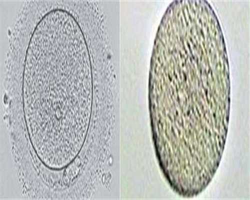 成都有助孕妈妈的医院吗,成都三代试管医院怎么样(成都做三代试管有哪些要求